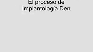 Implantologia Dental