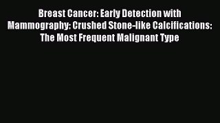 Download Breast Cancer: Early Detection with Mammography: Crushed Stone-like Calcifications: