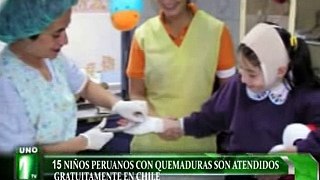 15 NIÑOS PERUANOS CON QUEMADURAS SON ATENDIDOS GRATUITAMENTE EN CHILE