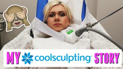 COOLSCULPTING MY CHIN: FOLLOW ME & ALL YOUR QUESTIONS ANSWERED!!