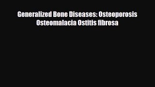 Download Generalized Bone Diseases: Osteoporosis Osteomalacia Ostitis fibrosa PDF Online