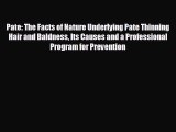 FREE DOWNLOAD Pate: The Facts of Nature Underlying Pate Thinning Hair and Baldness Its Causes