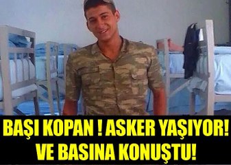 Kellesi Kopan Asker Yaşıyor