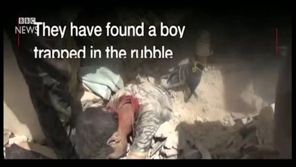 MREKULLI NEN RRENOJA NE ALEPPO PAS BOMBARDIMEVE SHPETOHET LIVE FEMIJA LAJM