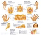 Rheumatoid Arthritis Symptoms