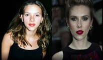 Las celebridades antes y después de las cirugías