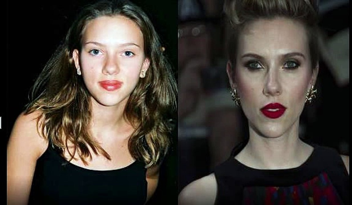 Las celebridades antes y después de las cirugías