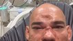 Evangelista 'Cyborg' Santos Has Gruesome Dent In His Head After Bellator Fight