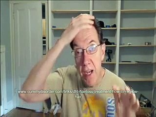 How to reverse DHT Hormone Male Balding especially top patch balding