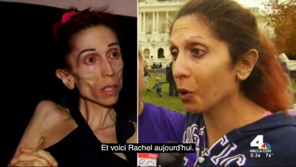 Ce mannequin a passé un appel il y a quelques mois, regardez sa métamorphose !