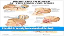 Download Whiplash Injuries of the Head and Neck Anatomical Chart  Ebook Online