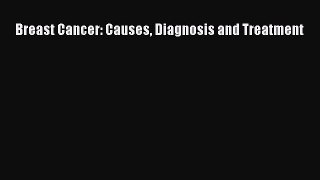 Read Breast Cancer: Causes Diagnosis and Treatment Ebook Free