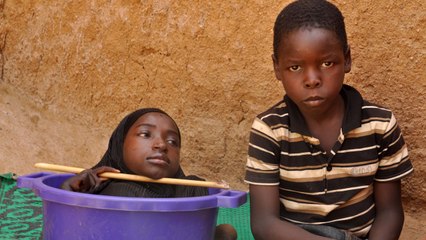 The Girl Who Lives In A Bowl: BORN DIFFERENT