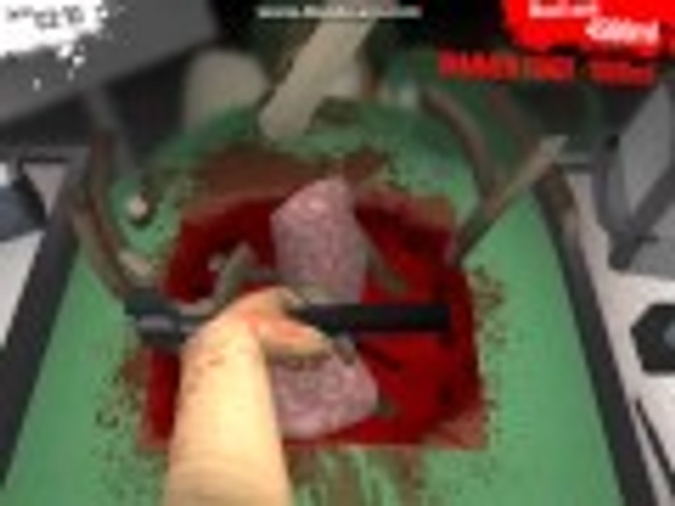 ✪NFTD✪ 疾風的 SurgeonSimulator 手術實況 可憐的史帝夫