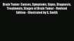 Download Brain Tumor: Causes Symptoms Signs Diagnosis Treatments Stages of Brain Tumor - Revised