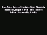 Download Brain Tumor: Causes Symptoms Signs Diagnosis Treatments Stages of Brain Tumor - Revised