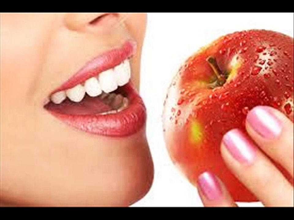 All about Invisalign
