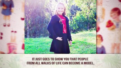 The Most Unusual Women Who Model