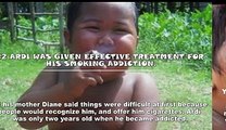 Do You Remember The Boy Who Smokes 40 Cigarettes a Day-