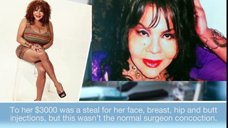 10 Cases of Plastic Surgery Gone Terribly Wrong