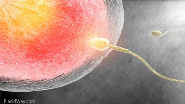 Tubal Ligation Reversal Clinic in Mexico - Laparoscopic Tubal Ligation