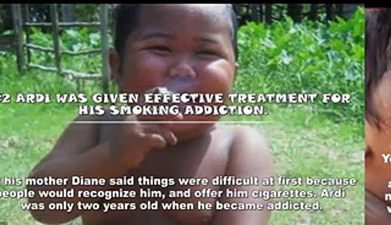 Do You Know The Boy Who Smokes 40 Cigarettes a Day See What He Looks Like 8