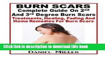 Read Burn Scars : Complete Guide On 2nd And 3rd Degree Burn Scars: Treatments, Healing, Fading And