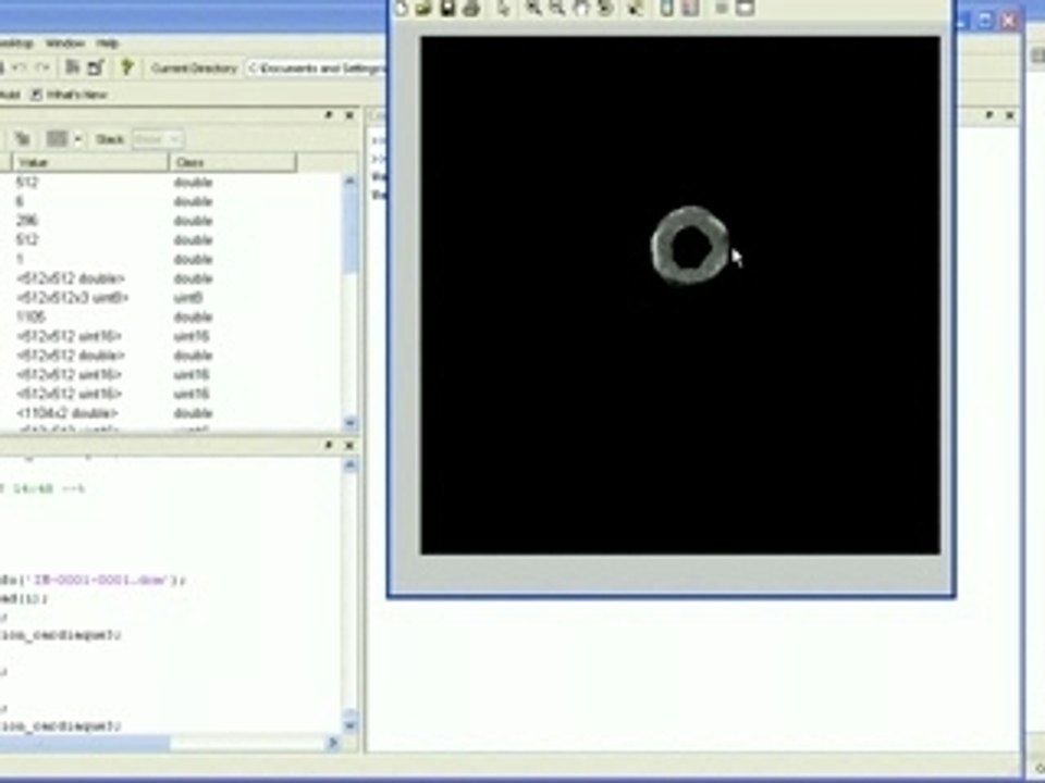 Demo segmentation cardiaque