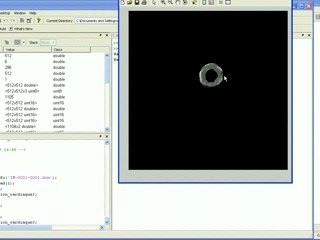 Demo segmentation cardiaque