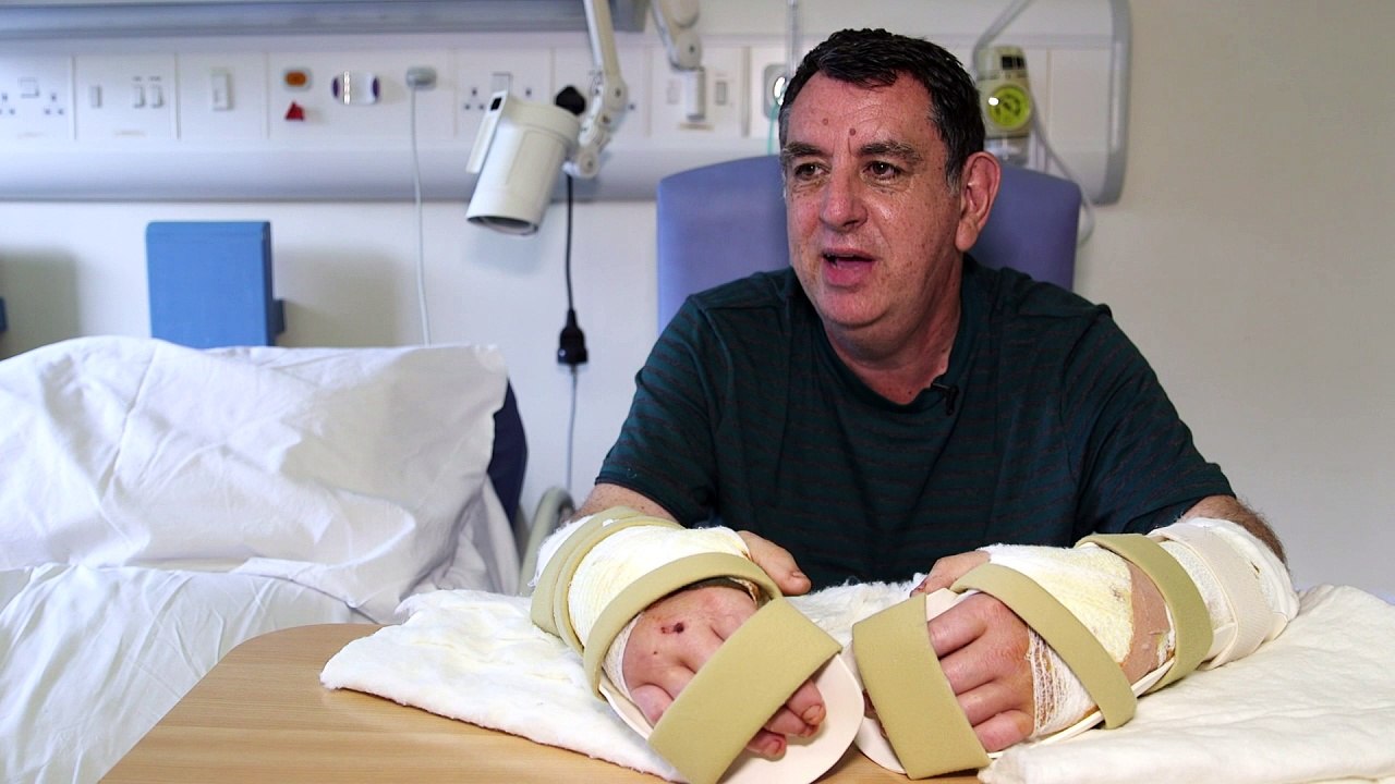 Double hand transplant recipient: "I feel whole again"
