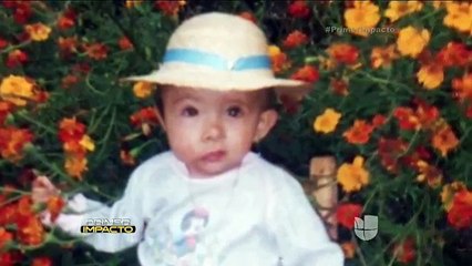 La extraña deformidad en el rostro de una niña de 13 años