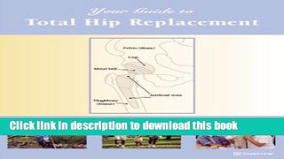 Download Your Guide to Total Hip Replacement  Ebook Online