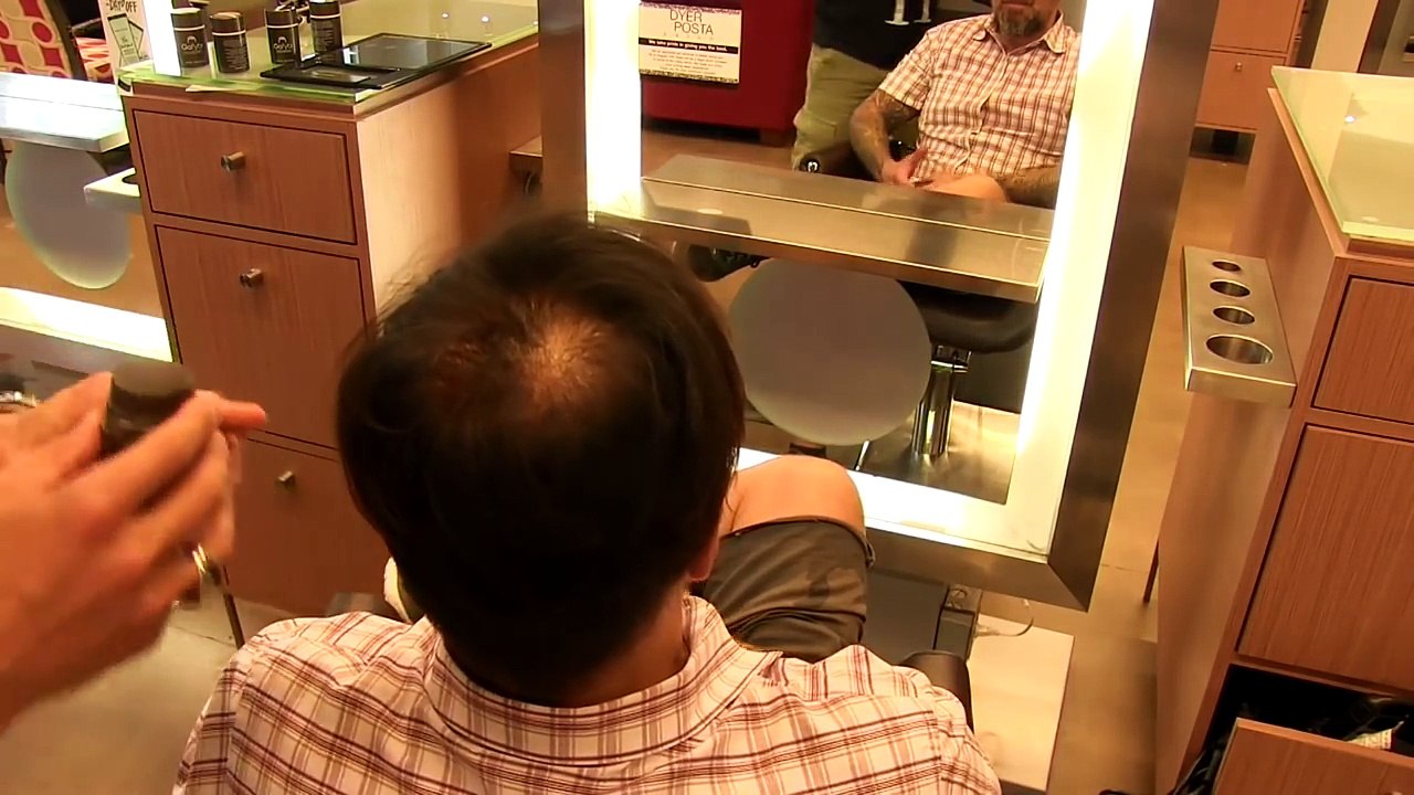 TOP 5 Hair Loss Treatment Options On The Market - Hair Loss Tips -