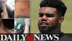 Ezekiel Elliott Accused Of Beating Woman The Alleged Victim Posts Photos