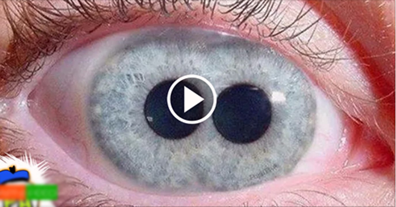 15-Real-Life-Human-Superpowers