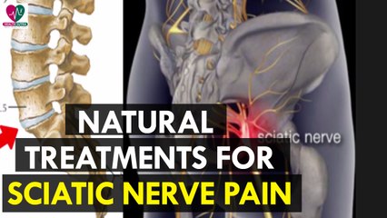 Natural Treatments for Sciatic Nerve Pain - Health Sutra