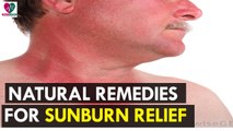 Natural Remedies for Sunburn Relief - Health Sutra