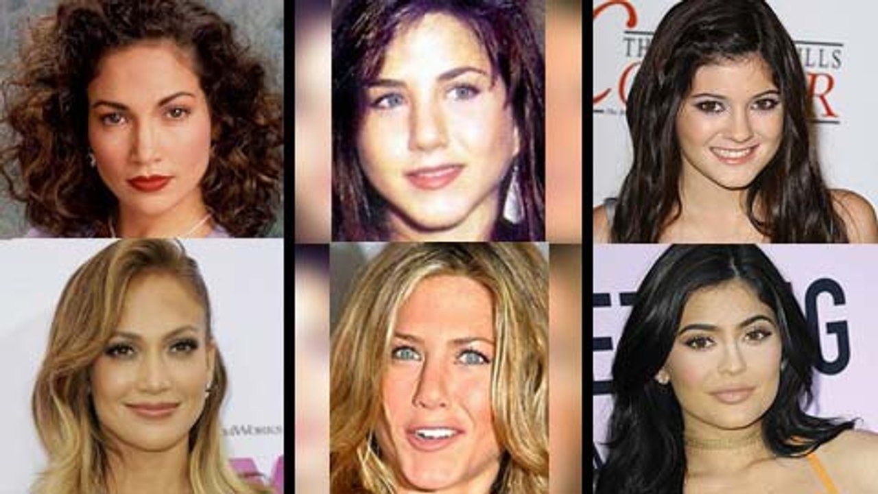 Before & After Plastic Surgery - Miley Cyrus, Kylie Jenner, Kim Kardashian & Other Stars