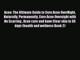Read Acne: The Ultimate Guide to Cure Acne OverNight Naturally Permanently Cure Acne Overnight