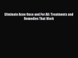 Read Eliminate Acne Once and For All: Treatments and Remedies That Work Ebook Free