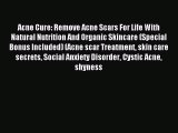 Download Acne Cure: Remove Acne Scars For Life With Natural Nutrition And Organic Skincare