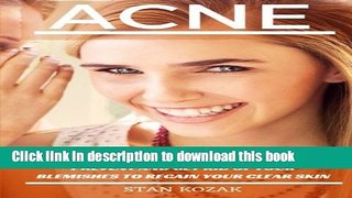 Download Books Acne: The Ultimate Guide on How To Both Prevent and Get Rid Of Your Blemishes to