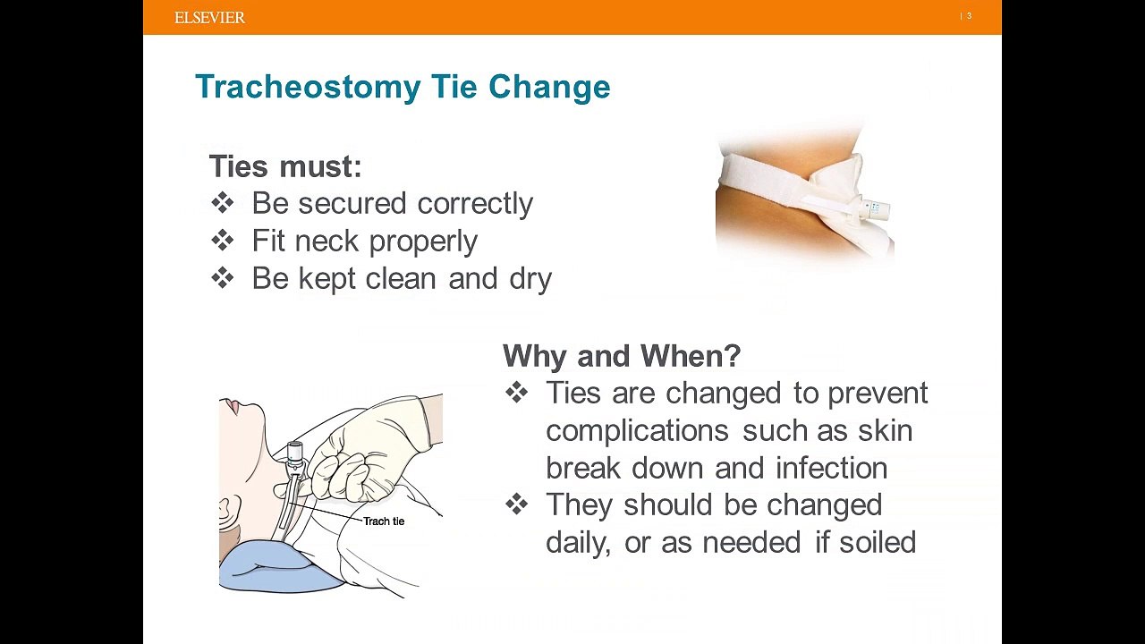 Episode 1: Tracheostomy Tie Change