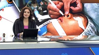 Doç.Dr.Hayati Akbaş-Burun Estetiği-kanal 24 haber bülteni