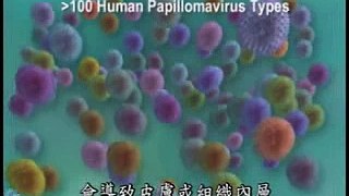 IVF HPV-1.wmv