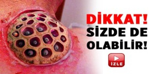 Tripofobi Delik Fobisi (Trypophobia) #tripofobi