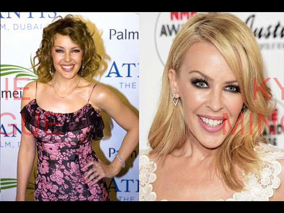 20 famosos antes y después de la cirugìa