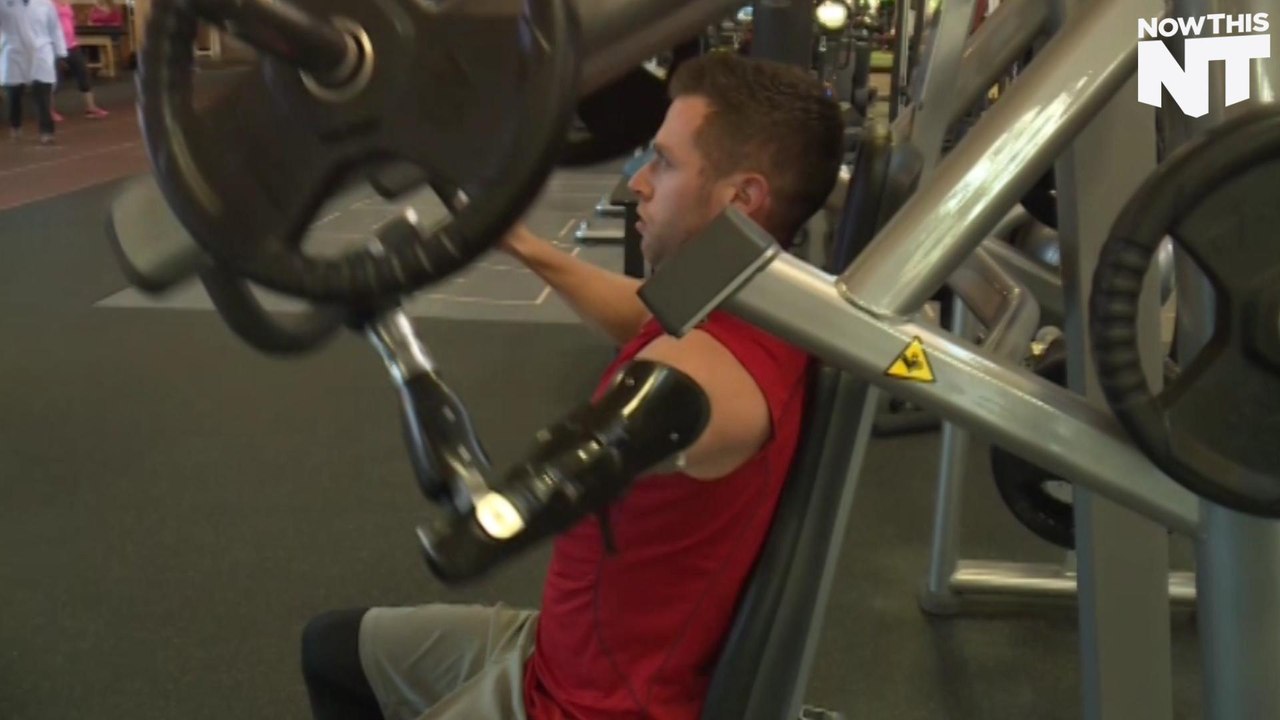 Bionic Arm Allows Man to Lift Weights