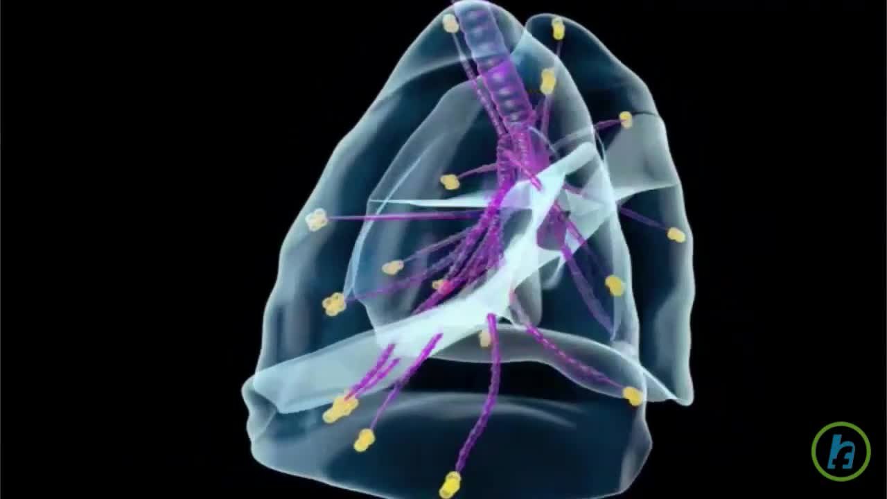 What is Asthma?