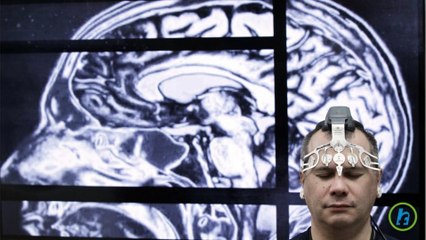 Brain Injury Evidence Discovered In Living NFL Veterans